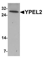 YPEL2 Antibody in Western Blot (WB)