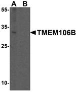 TMEM106B Antibody in Western Blot (WB)