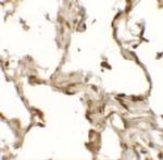 TFEB Antibody in Immunohistochemistry (IHC)