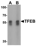 TFEB Antibody in Western Blot (WB)