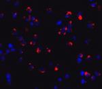 Dectin 1 Antibody in Immunocytochemistry (ICC/IF)