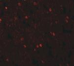 SHANK3 Antibody in Immunohistochemistry (IHC)