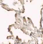 NBS1 Antibody in Immunohistochemistry (IHC)