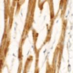 FCHO2 Antibody in Immunohistochemistry (IHC)