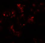 TTYH2 Antibody in Immunohistochemistry (IHC)