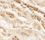 TTYH2 Antibody in Immunohistochemistry (IHC)