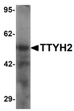 TTYH2 Antibody in Western Blot (WB)