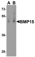 BMP-15 Antibody in Western Blot (WB)