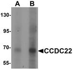 CCDC22 Antibody in Western Blot (WB)