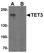 TET3 Antibody in Western Blot (WB)