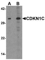 p57 Kip2 Antibody in Western Blot (WB)