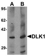 DLK1 Antibody in Western Blot (WB)