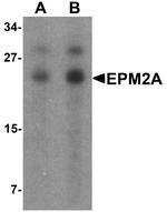 EPM2A Antibody in Western Blot (WB)