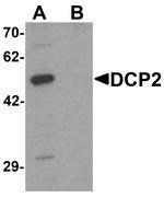 DCP2 Antibody in Western Blot (WB)