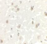 LMX1A Antibody in Immunohistochemistry (IHC)