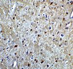 LMX1A Antibody in Immunohistochemistry (IHC)