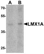 LMX1A Antibody in Western Blot (WB)