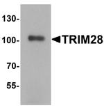 TRIM28 Antibody in Western Blot (WB)