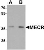 MECR Antibody in Western Blot (WB)