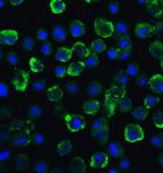 TYK2 Antibody in Immunocytochemistry (ICC/IF)