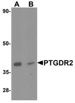 CRTH2 Antibody in Western Blot (WB)