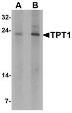 TPT1 Antibody in Western Blot (WB)