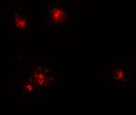 MCP-1 Antibody in Immunohistochemistry (IHC)