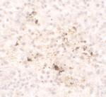 MCP-1 Antibody in Immunohistochemistry (IHC)