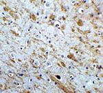 NELF Antibody in Immunohistochemistry (IHC)