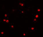 PIBF1 Antibody in Immunohistochemistry (IHC)