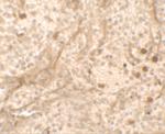 PIBF1 Antibody in Immunohistochemistry (IHC)