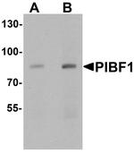 PIBF1 Antibody in Western Blot (WB)