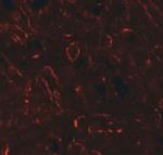 OX40L Antibody in Immunohistochemistry (IHC)