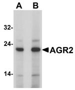 AGR2 Antibody in Western Blot (WB)