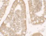 RC3H1 Antibody in Immunohistochemistry (IHC)