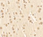 NUCB2 Antibody in Immunohistochemistry (IHC)