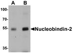 NUCB2 Antibody in Western Blot (WB)