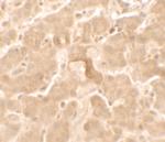 GBP5 Antibody in Immunohistochemistry (IHC)