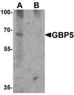 GBP5 Antibody in Western Blot (WB)