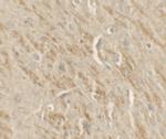 TIP60 Antibody in Immunohistochemistry (IHC)