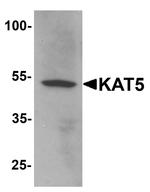 TIP60 Antibody in Western Blot (WB)