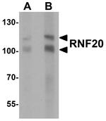 RNF20 Antibody in Western Blot (WB)