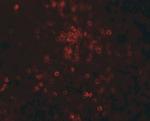 TLX3 Antibody in Immunohistochemistry (IHC)