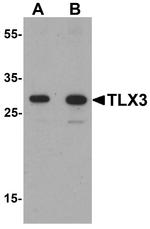 TLX3 Antibody in Western Blot (WB)