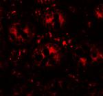 DAP Antibody in Immunohistochemistry (IHC)