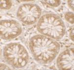 DAP Antibody in Immunohistochemistry (IHC)