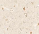 PRAS40 Antibody in Immunohistochemistry (IHC)