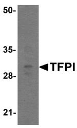 TFPI Antibody in Western Blot (WB)