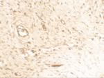 Osteopontin Antibody in Immunohistochemistry (IHC)