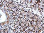 Phospho-CHK1 (Ser345) Antibody in Immunohistochemistry (Paraffin) (IHC (P))